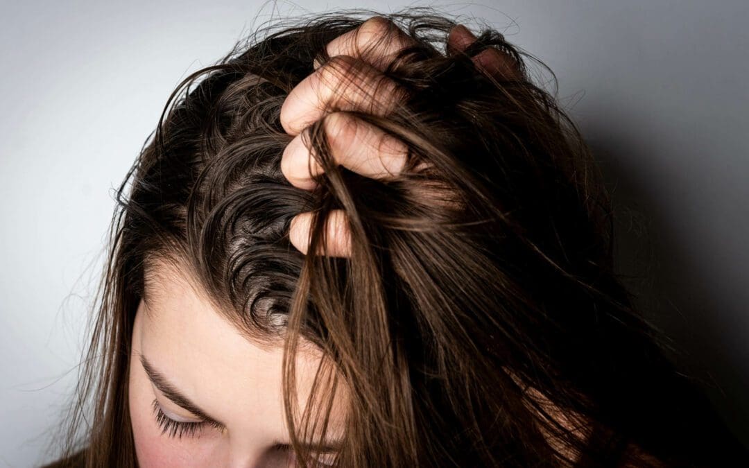 What Causes Oily Hair and How to Fix It